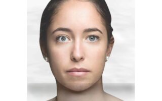 Best Treatment for Myasthenia Gravis in Thane – Rebuild Muscle Strength