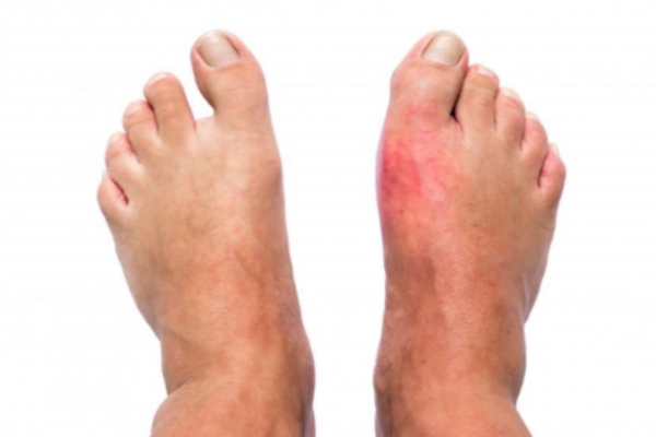  Peripheral Neuropathy Care in Thane Leading Peripheral Neuropathy Specialist in Thane Advanced Treat
