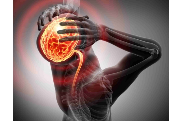  Managing Idiopathic Intracranial Hypertension: A Specialist’s Approach