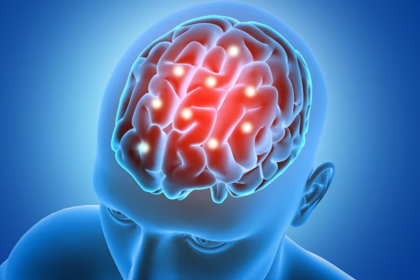  Autoimmune Encephalitis: Comprehensive Care for a Complex Condition
