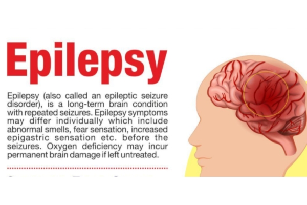  Epilepsy and Seizure Management in Thane – Dr. Deepak Aiwale Best Epilepsy Specialist Near Me